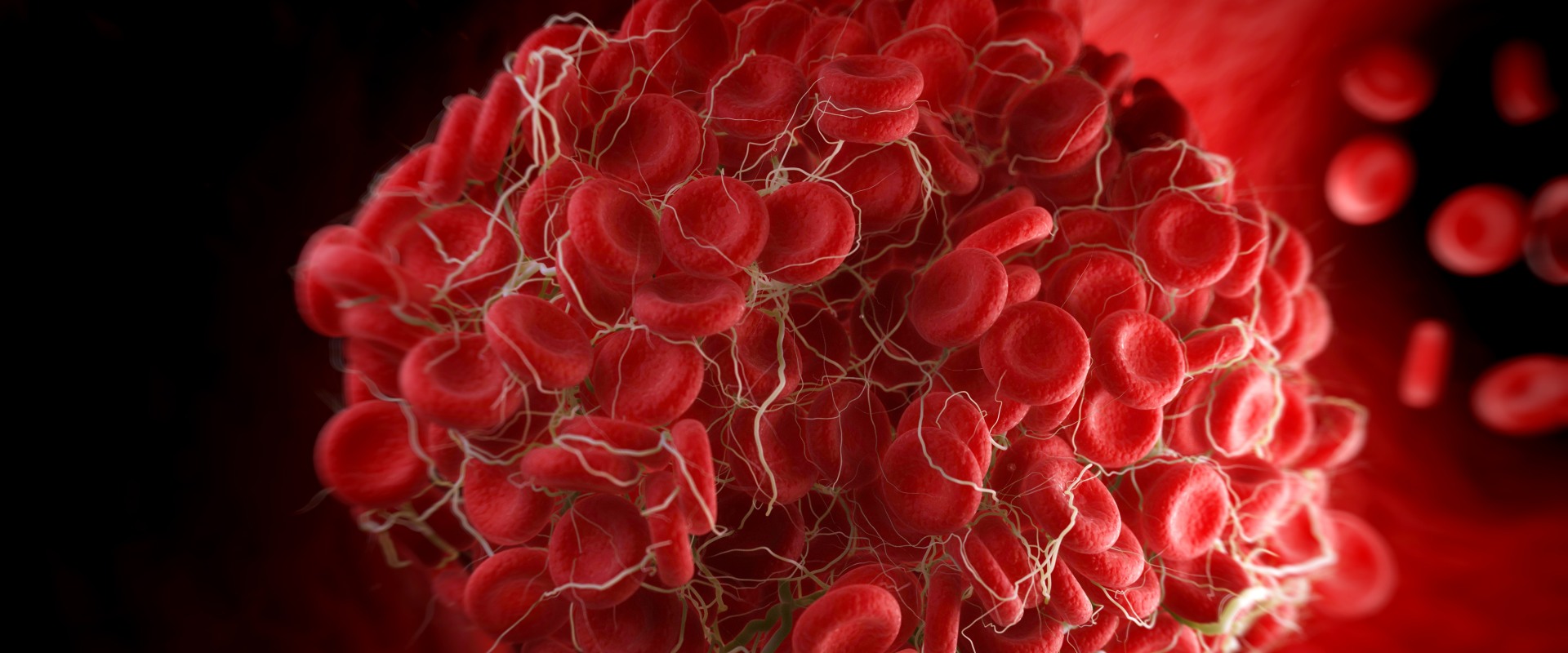 The Basics of Blood Clots and Cosmetic Surgery