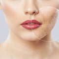 Laser Skin Resurfacing Treatments: Improved Skin Texture and Tone
