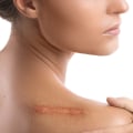 Scarring and Discomfort: Understanding the Risks of Aesthetic Surgery