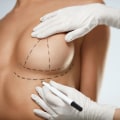 Enhancing Self-Confidence: Benefits of Cosmetic Surgery