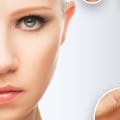 Reduced Signs of Aging and Sun Damage: Aesthetic Surgery Benefits